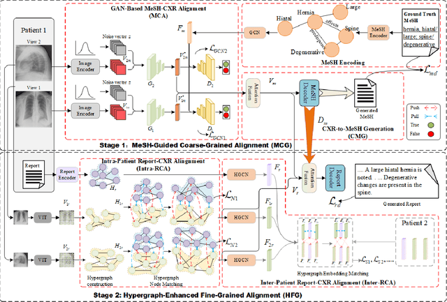 Figure 3 for DAMPER: A Dual-Stage Medical Report Generation Framework with Coarse-Grained MeSH Alignment and Fine-Grained Hypergraph Matching