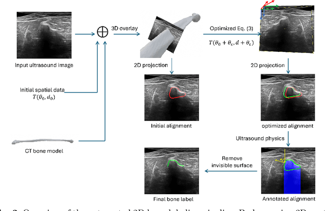 Figure 3 for UltraBones100k: An Ultrasound Image Dataset with CT-Derived Labels for Lower Extremity Long Bone Surface Segmentation