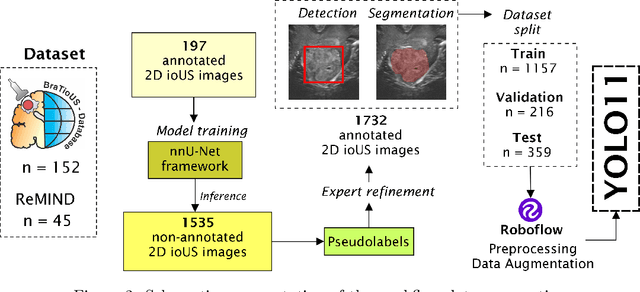 Figure 4 for Real-Time Brain Tumor Detection in Intraoperative Ultrasound Using YOLO11: From Model Training to Deployment in the Operating Room