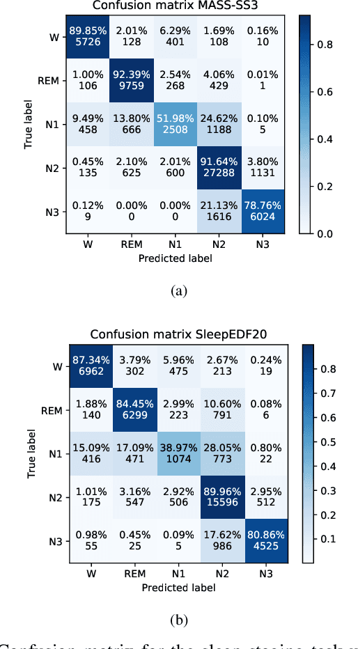 Figure 3 for ProductGraphSleepNet: Sleep Staging using Product Spatio-Temporal Graph Learning with Attentive Temporal Aggregation