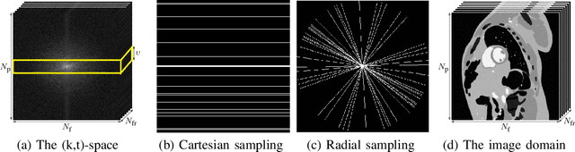 Figure 1 for Multi-Linear Kernel Regression and Imputation in Data Manifolds