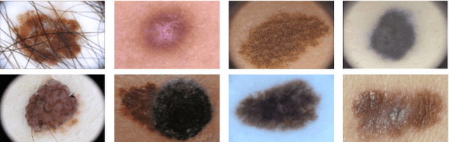 Figure 1 for Web-based Melanoma Detection