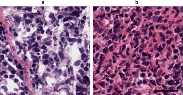 Figure 1 for Enhancing frozen histological section images using permanent-section-guided deep learning with nuclei attention