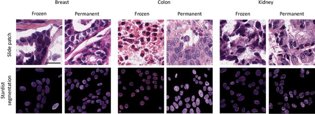 Figure 3 for Enhancing frozen histological section images using permanent-section-guided deep learning with nuclei attention