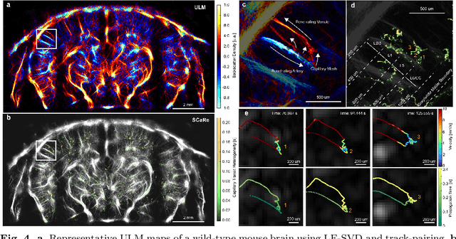 Figure 4 for Functional Assessment of Cerebral Capillaries using Single Capillary Reporters in Ultrasound Localization Microscopy