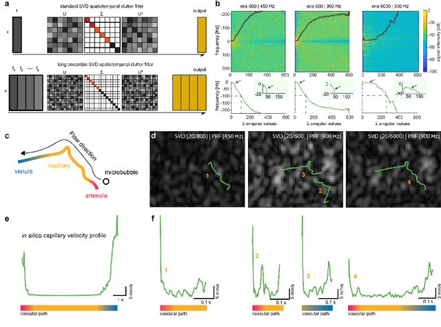 Figure 3 for Functional Assessment of Cerebral Capillaries using Single Capillary Reporters in Ultrasound Localization Microscopy