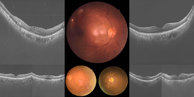Figure 1 for An Organism Starts with a Single Pix-Cell: A Neural Cellular Diffusion for High-Resolution Image Synthesis