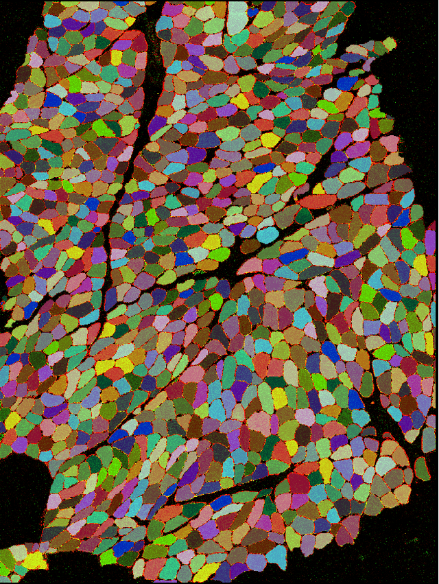 Figure 3 for Introducing NCL-SM: A Fully Annotated Dataset of Images from Human Skeletal Muscle Biopsies