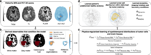 Figure 1 for Physics-Regularized Multi-Modal Image Assimilation for Brain Tumor Localization