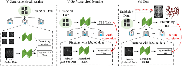 Figure 1 for Benefit from public unlabeled data: A Frangi filtering-based pretraining network for 3D cerebrovascular segmentation