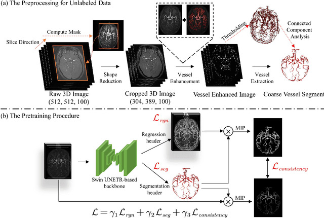 Figure 3 for Benefit from public unlabeled data: A Frangi filtering-based pretraining network for 3D cerebrovascular segmentation