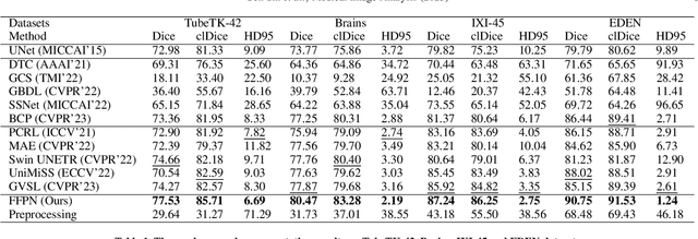 Figure 2 for Benefit from public unlabeled data: A Frangi filtering-based pretraining network for 3D cerebrovascular segmentation