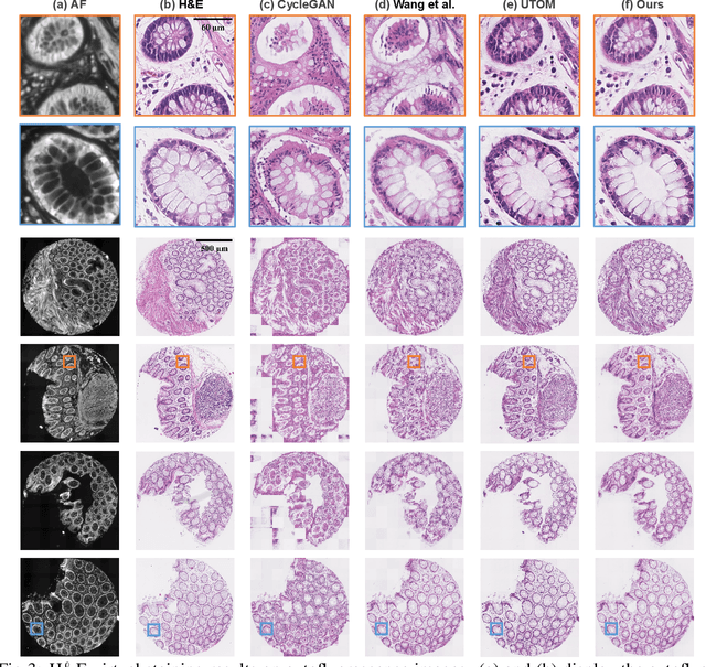 Figure 4 for A Value Mapping Virtual Staining Framework for Large-scale Histological Imaging