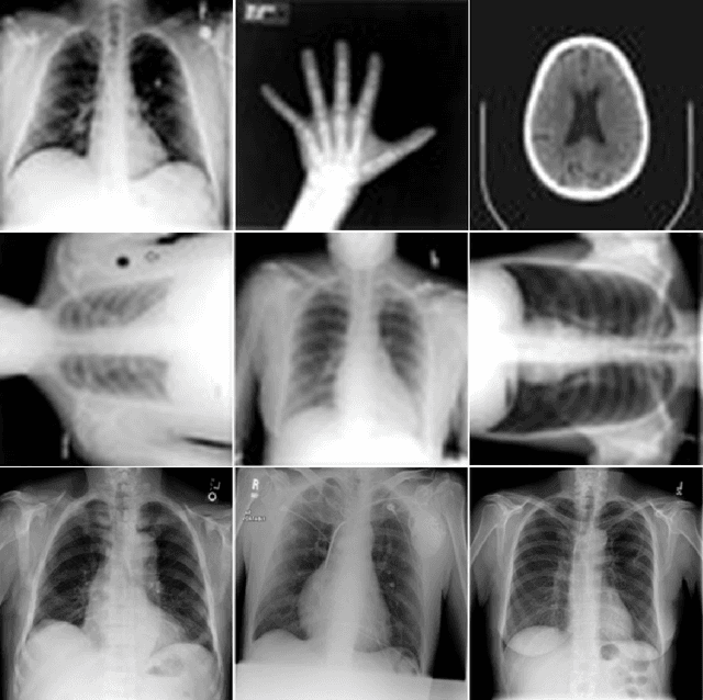 Figure 1 for Applications of Sequential Learning for Medical Image Classification