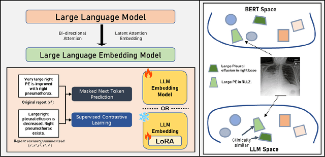 Figure 1 for Exploring the Capabilities of LLM Encoders for Image-Text Retrieval in Chest X-rays