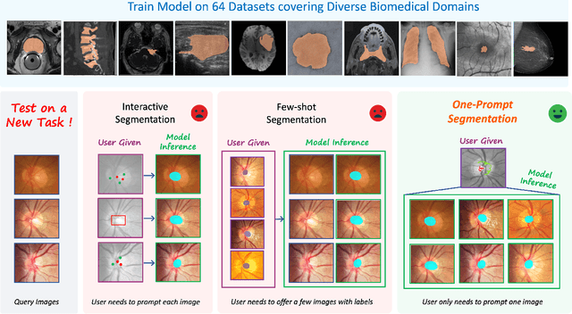 Figure 1 for PromptUNet: Toward Interactive Medical Image Segmentation