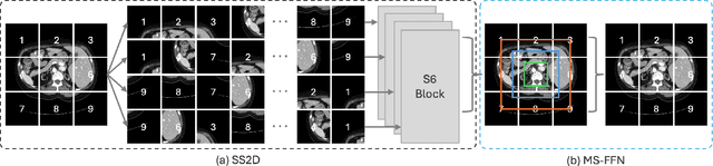 Figure 2 for MSVM-UNet: Multi-Scale Vision Mamba UNet for Medical Image Segmentation