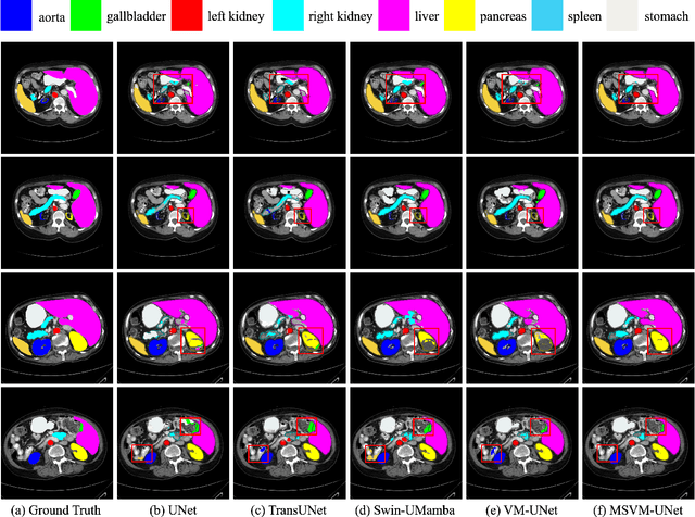 Figure 4 for MSVM-UNet: Multi-Scale Vision Mamba UNet for Medical Image Segmentation