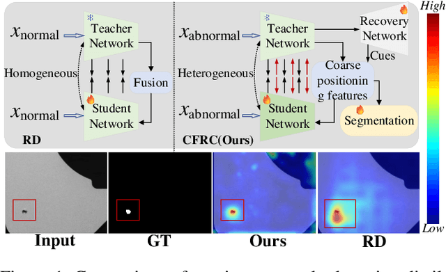 Figure 1 for 3CAD: A Large-Scale Real-World 3C Product Dataset for Unsupervised Anomaly