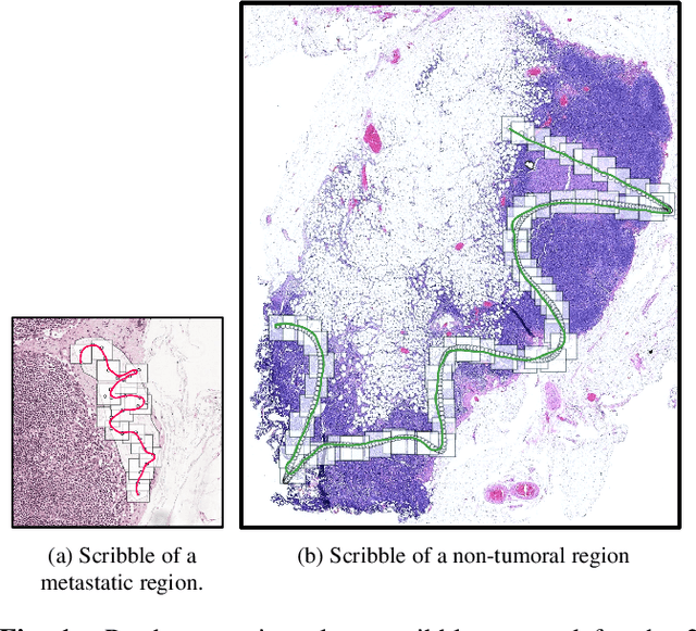 Figure 1 for Scribble-based fast weak-supervision and interactive corrections for segmenting whole slide images