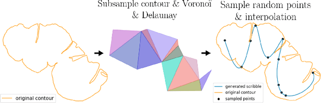 Figure 3 for Scribble-based fast weak-supervision and interactive corrections for segmenting whole slide images