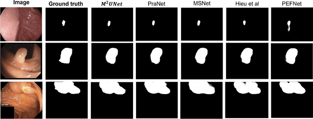 Figure 2 for M^2UNet: MetaFormer Multi-scale Upsampling Network for Polyp Segmentation