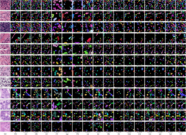 Figure 3 for Cyclic Learning: Bridging Image-level Labels and Nuclei Instance Segmentation