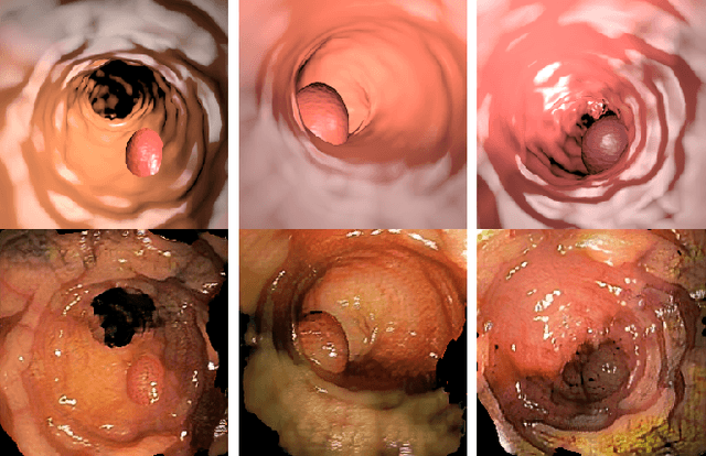 Figure 3 for Self-Supervised and Semi-Supervised Polyp Segmentation using Synthetic Data