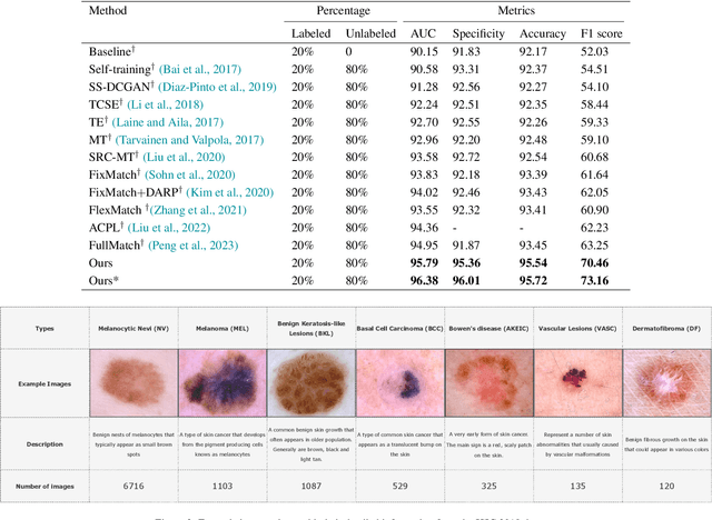 Figure 4 for SPLAL: Similarity-based pseudo-labeling with alignment loss for semi-supervised medical image classification