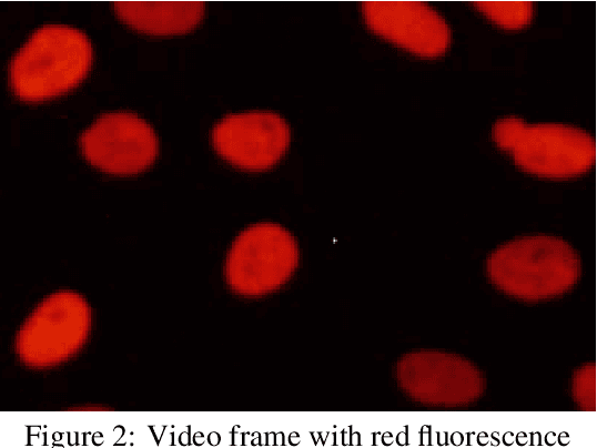 Figure 2 for Method of Tracking and Analysis of Fluorescent-Labeled Cells Using Automatic Thresholding and Labeling