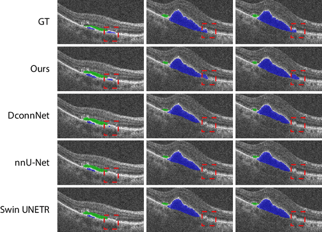 Figure 3 for Spectral U-Net: Enhancing Medical Image Segmentation via Spectral Decomposition