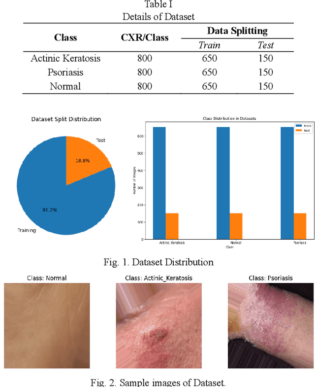 Figure 3 for Skin Disease Detection and Classification of Actinic Keratosis and Psoriasis Utilizing Deep Transfer Learning