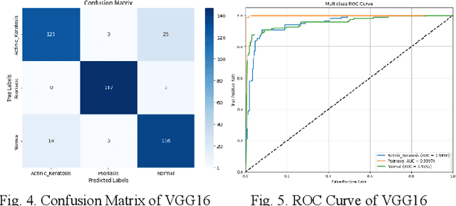 Figure 2 for Skin Disease Detection and Classification of Actinic Keratosis and Psoriasis Utilizing Deep Transfer Learning