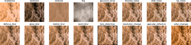 Figure 1 for Leveraging Pre-trained Models for Robust Federated Learning for Kidney Stone Type Recognition