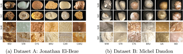 Figure 4 for Leveraging Pre-trained Models for Robust Federated Learning for Kidney Stone Type Recognition