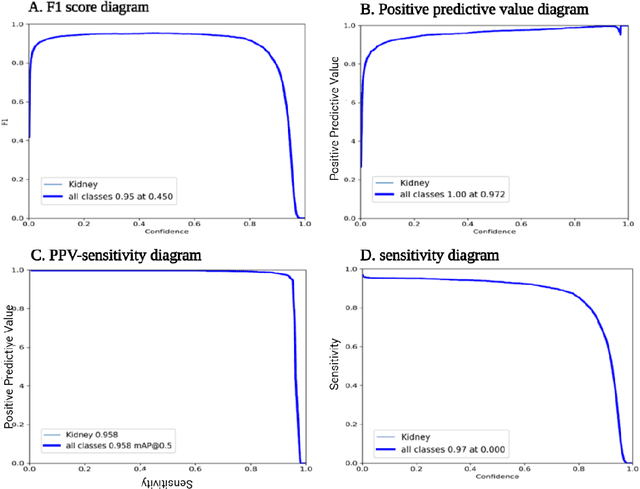 Figure 3 for Using YOLO v7 to Detect Kidney in Magnetic Resonance Imaging