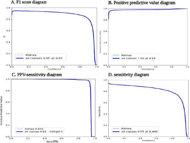 Figure 4 for Using YOLO v7 to Detect Kidney in Magnetic Resonance Imaging