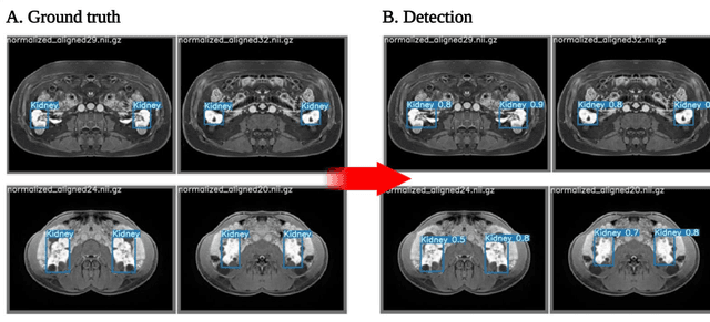 Figure 1 for Using YOLO v7 to Detect Kidney in Magnetic Resonance Imaging