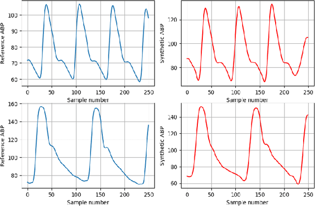 Figure 3 for Cuff-less Arterial Blood Pressure Waveform Synthesis from Single-site PPG using Transformer & Frequency-domain Learning