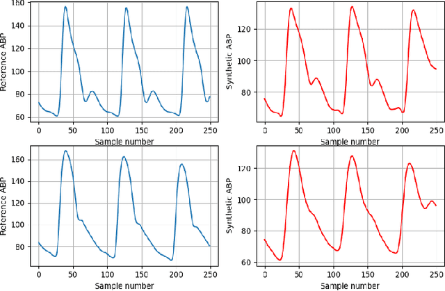 Figure 4 for Cuff-less Arterial Blood Pressure Waveform Synthesis from Single-site PPG using Transformer & Frequency-domain Learning