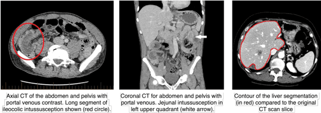 Figure 1 for Visual Prompt Engineering for Medical Vision Language Models in Radiology