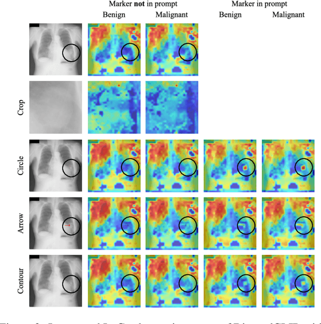 Figure 4 for Visual Prompt Engineering for Medical Vision Language Models in Radiology