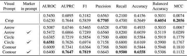 Figure 2 for Visual Prompt Engineering for Medical Vision Language Models in Radiology