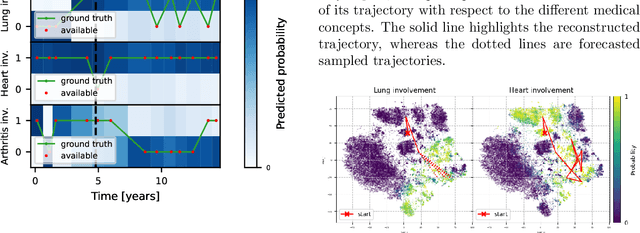 Figure 4 for Modeling Complex Disease Trajectories using Deep Generative Models with Semi-Supervised Latent Processes