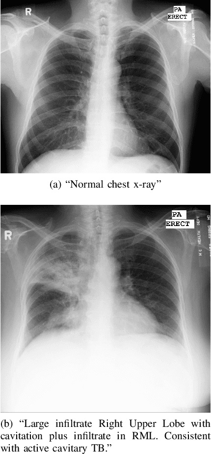 Figure 1 for Exploring Foundation Models for Synthetic Medical Imaging: A Study on Chest X-Rays and Fine-Tuning Techniques