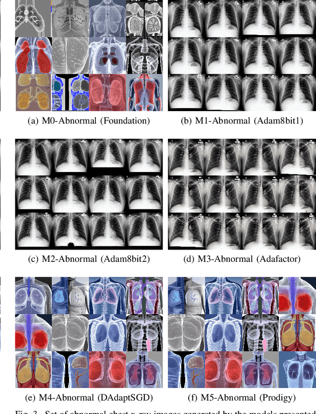 Figure 3 for Exploring Foundation Models for Synthetic Medical Imaging: A Study on Chest X-Rays and Fine-Tuning Techniques