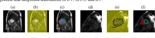 Figure 3 for DuEDL: Dual-Branch Evidential Deep Learning for Scribble-Supervised Medical Image Segmentation