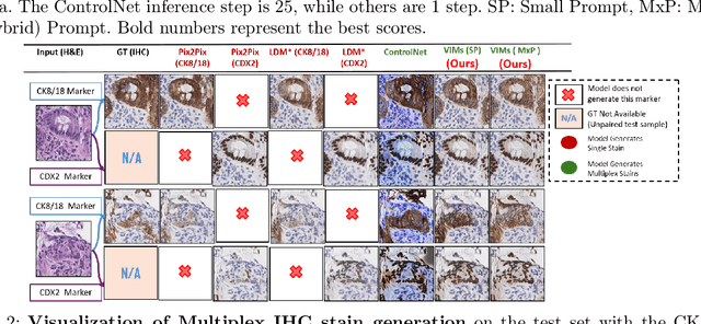 Figure 3 for VIMs: Virtual Immunohistochemistry Multiplex staining via Text-to-Stain Diffusion Trained on Uniplex Stains