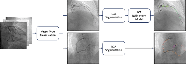 Figure 1 for MPSeg : Multi-Phase strategy for coronary artery Segmentation