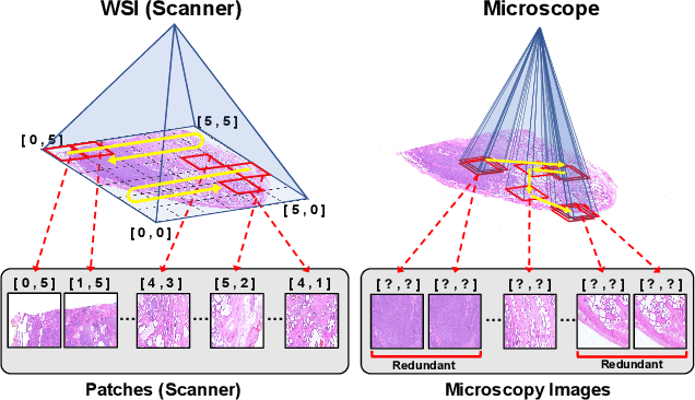 Figure 1 for MicroMIL: Graph-based Contextual Multiple Instance Learning for Patient Diagnosis Using Microscopy Images